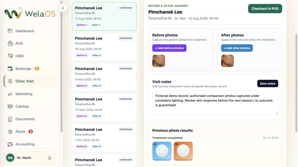 WelaOS Previous photo results section showing historical before-and-after images for a synthetic aesthetic customer